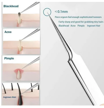 Ingrown Hair Tweezers